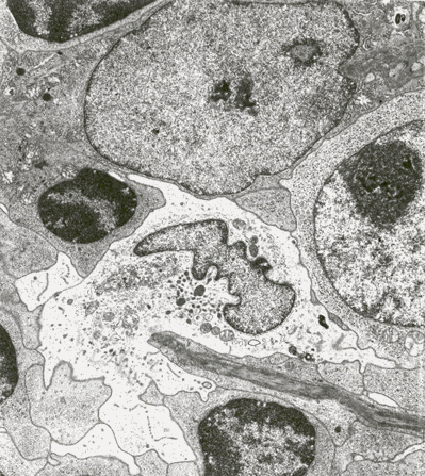 This mature Interdigititating Dendritic Cell is in contact with the fluid conducting fiber of the FRCC. Note that no cell cytoplasm or membranes separate the DC from the dark fiber. The fiber probably retains contact as it passes behind the IDC. Contact with the fiber may permit the IDC to sample chemokine signals and/or antigens flowing in the conduit.