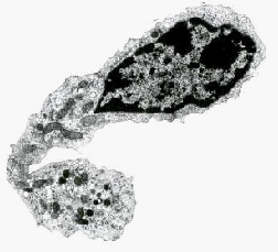 As the dendritic cell precursor begins to differentiate it develops this tadpole shape