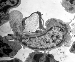 Upon attachment to the fibroblastic reticular cell conduits in lymphatic tissues, the dendritic cell asssures that its membrane is in contact with the fluid environment of the conduit at at least one point. Note the DC process making contact with the FRCC fiber between apposed membranes of the ensheathing reticular cell. Click for more detail.