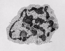 The Circulating form of dendritic cell precursor looks like a lymphocyte with an irregular nucleus and numerous mitochondria in the cytoplasm. Click image to see LY-DC comparison.