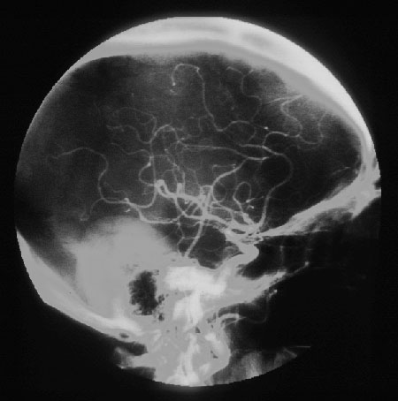 radiograph