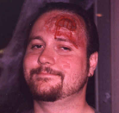 Head Wound