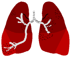 Ŧ lung