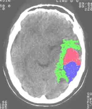 mm bleed ct_1.jpg (13520 bytes)