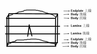 ap_lines_model.jpg (11846 bytes)