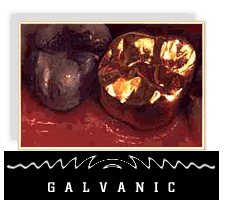 galvanic