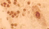 Anti-Hu antibody staining of cerebellar granule