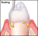 Scaling