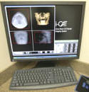 ICat Machine for Implants