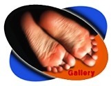 Sole & Feet Gallery