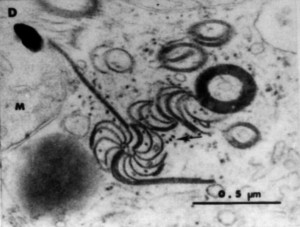 Cytopathology of WMV-2 on BT-2 bean