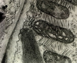 Cytopathology of PRV on tomato