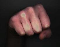 franklin kane's fist